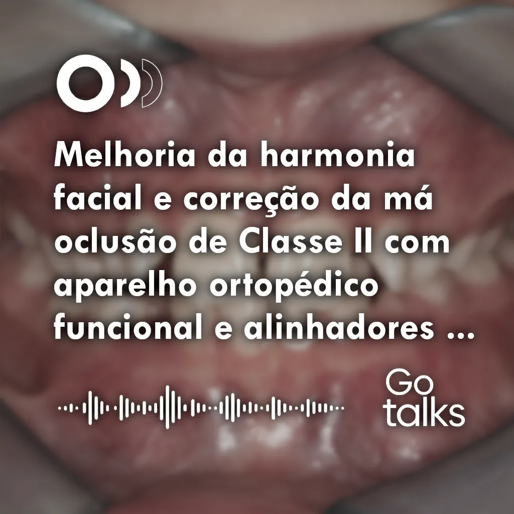 Melhoria da harmonia facial e correção da má oclusão de Classe II com aparelho ortopédico funcional e alinhadores transparentes: relato de caso