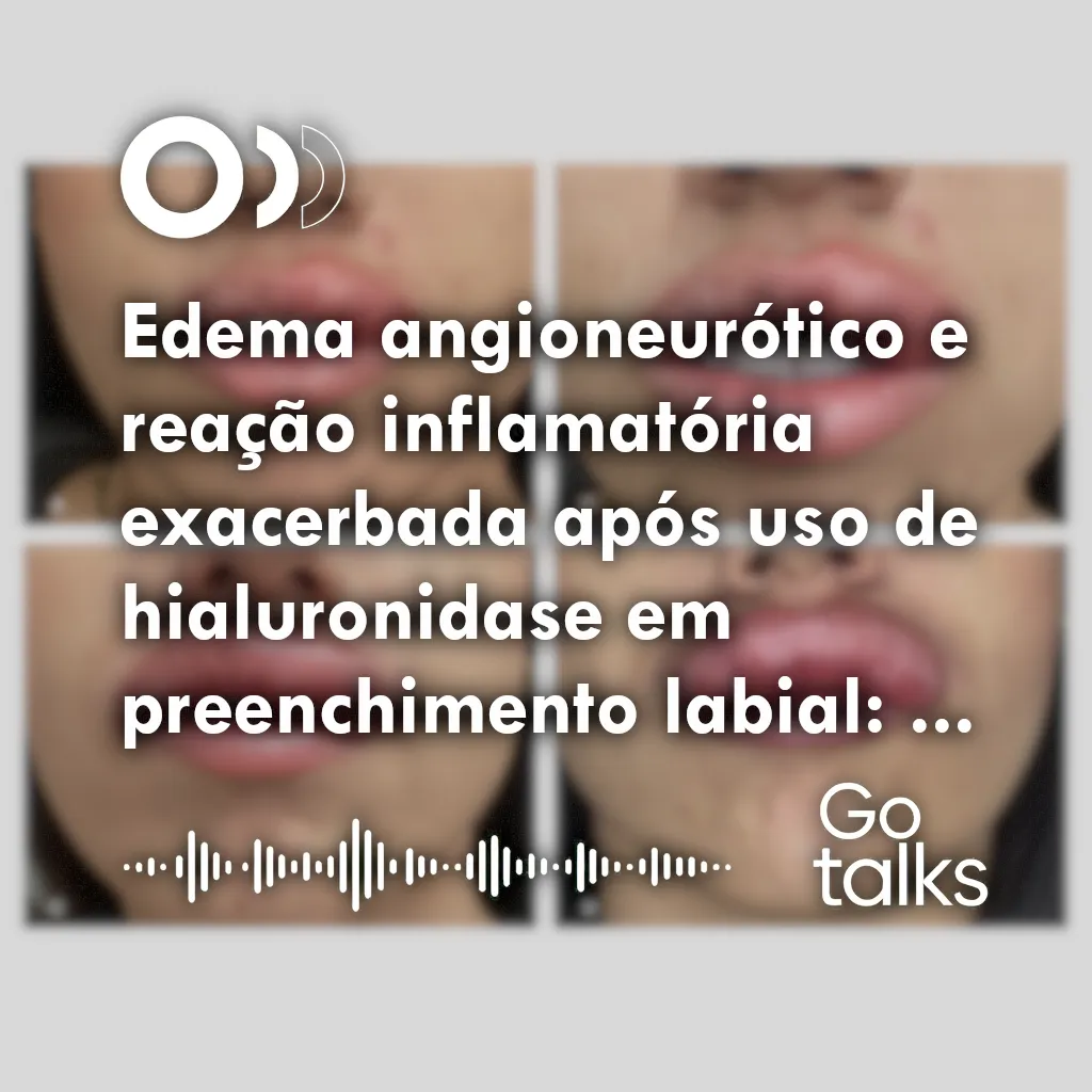 Edema angioneurótico e reação inflamatória exacerbada após uso de hialuronidase em preenchimento labial: relato de caso