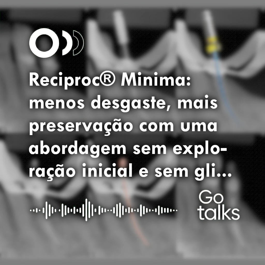 Reciproc® Minima: menos desgaste, mais preservação com uma abordagem sem exploração inicial e sem glide path
